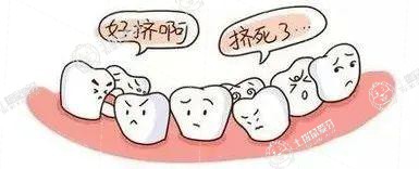牙齒擁擠怎么矯正