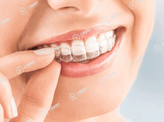 牙齒深覆合有必要矯正嗎