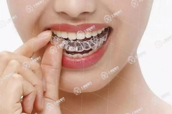 牙齒矯正畸形手術費用多少
