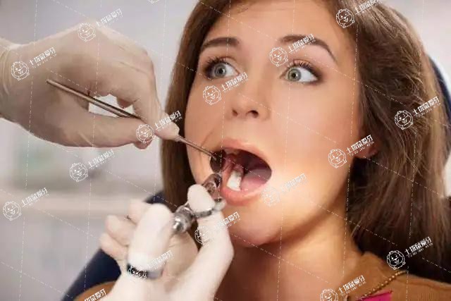 牙齒深覆合矯正的最佳年齡