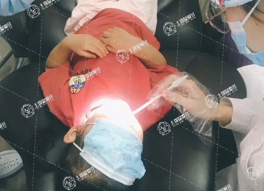 牙齒樹脂貼面怎么樣