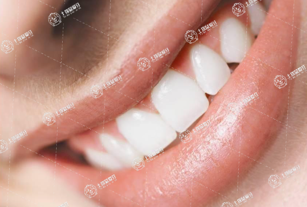 洗牙對口臭有效果嗎