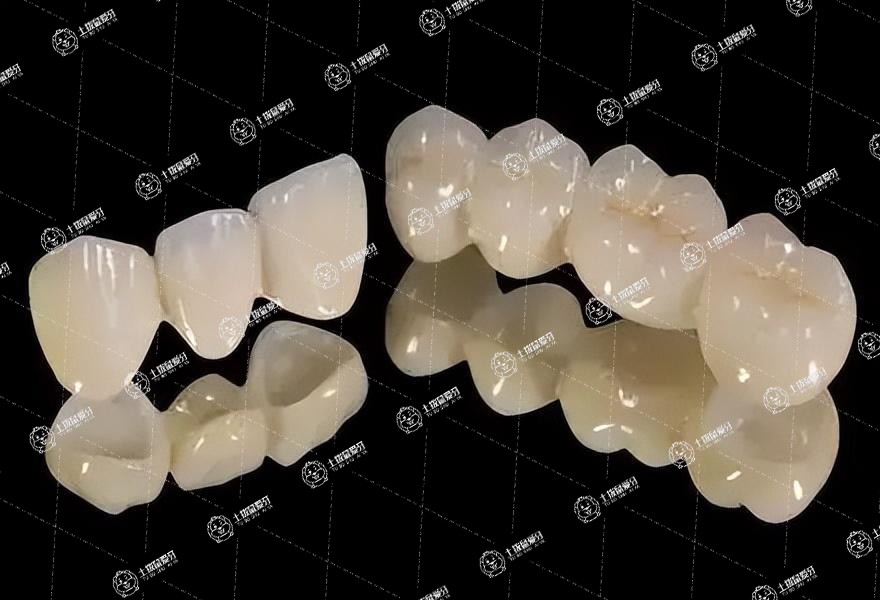 全瓷牙能用牙線清潔嗎