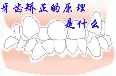 牙齒矯正