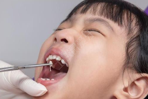 只有小孩子才能接受正畸治療嗎